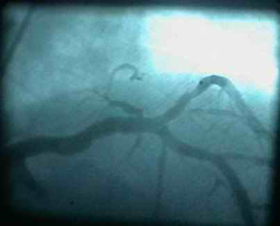 韩志华2007年德国进修日记(十)