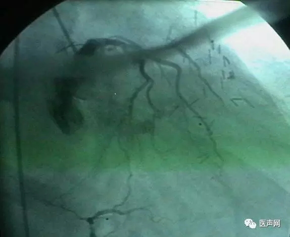 韩志华2007年德国进修日记(十二)