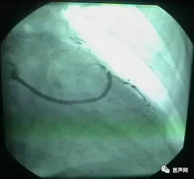 韩志华2007年德国进修日记(十二)