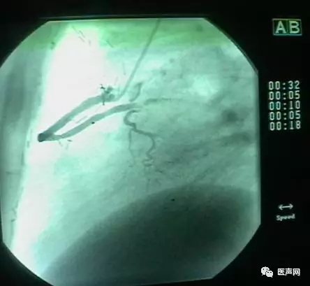 韩志华2007年德国进修日记(十二)