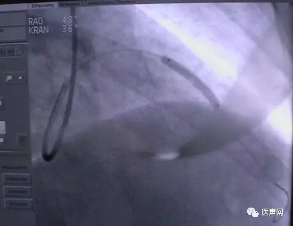 韩志华2007年德国进修日记(十二)