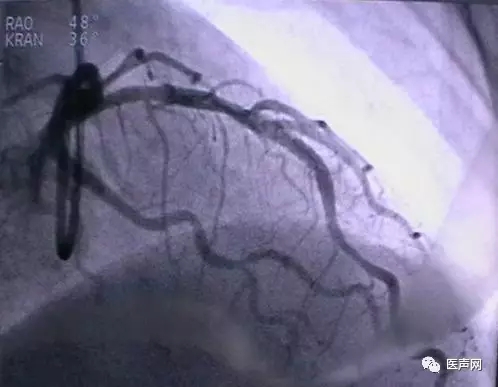 韩志华2007年德国进修日记(十二)