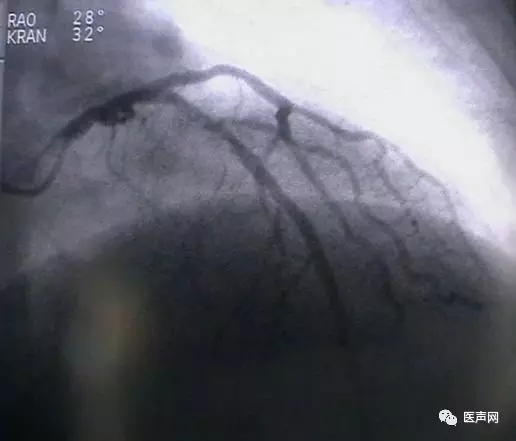 韩志华2007年德国进修日记(十二)