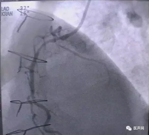 韩志华2007年德国进修日记(十二)