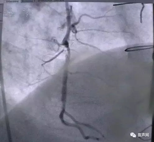 韩志华2007年德国进修日记(十二)