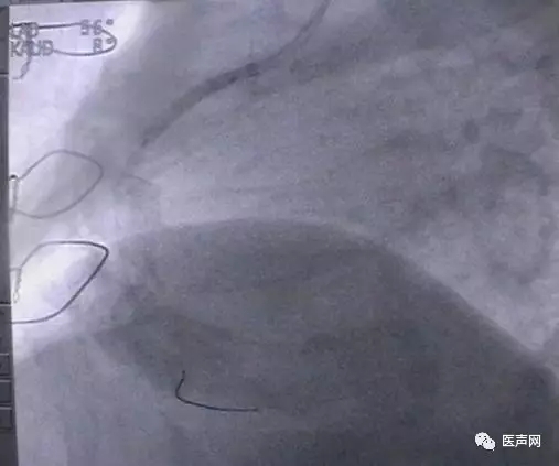 韩志华2007年德国进修日记(十二)