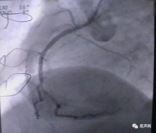 韩志华2007年德国进修日记(十二)