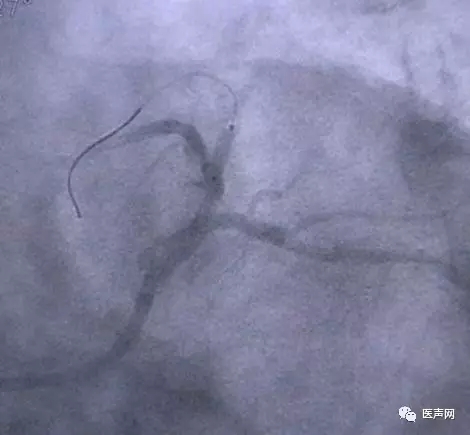 韩志华2007年德国进修日记(十二)