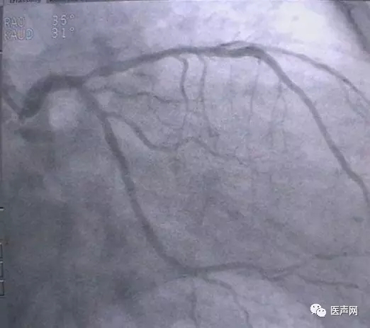 韩志华2007年德国进修日记(十二)