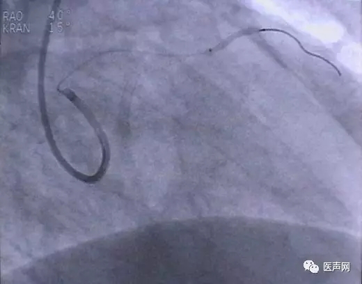 韩志华2007年德国进修日记(十二)