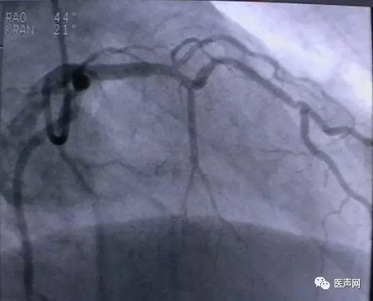 韩志华2007年德国进修日记(十二)