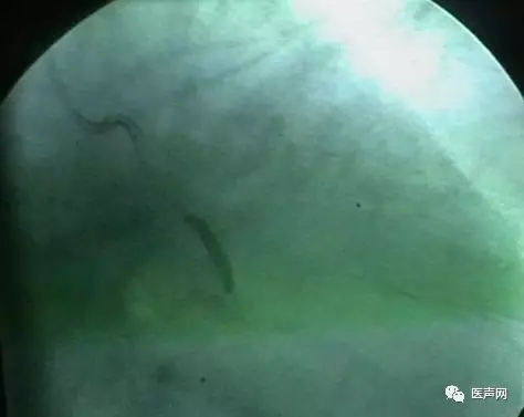 韩志华2007年德国进修日记(十二)