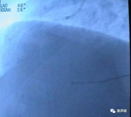 韩志华2007年德国进修日记(十二)