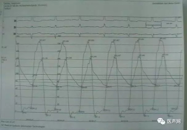 韩志华2007年德国进修日记(十二)