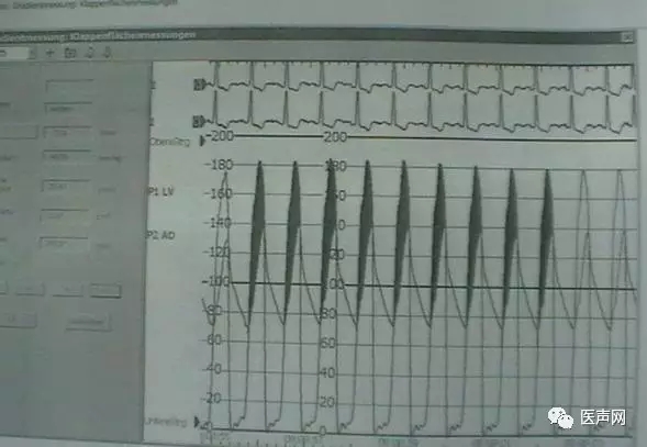 韩志华2007年德国进修日记(十二)