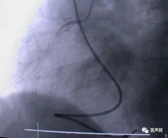 韩志华2007年德国进修日记(十二)