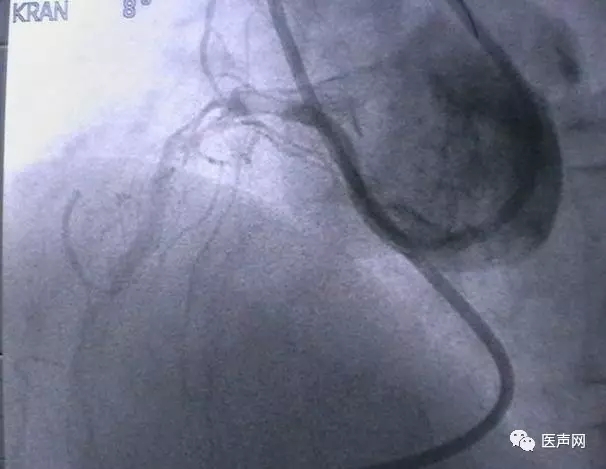 韩志华2007年德国进修日记(十二)