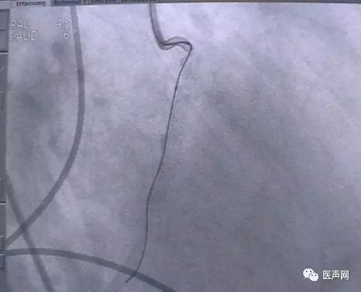 韩志华2007年德国进修日记(十二)