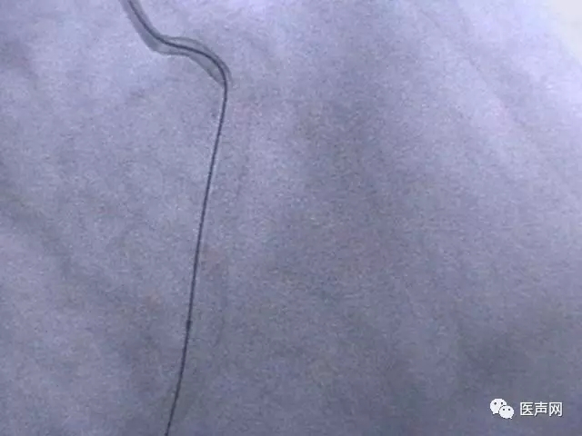 韩志华2007年德国进修日记(十二)