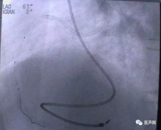 韩志华2007年德国进修日记(十二)