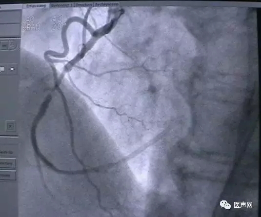 韩志华2007年德国进修日记(十二)