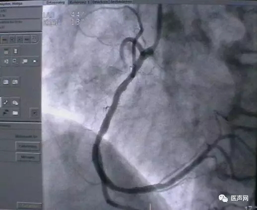 韩志华2007年德国进修日记(十二)