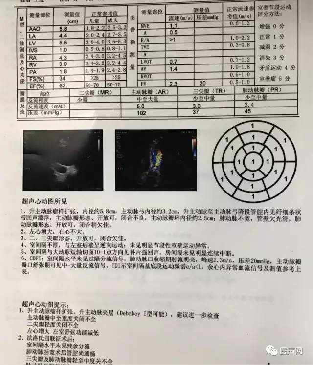 病例分享 | 跨越30年的病例 见证一代又一代心外科医生专注的力量