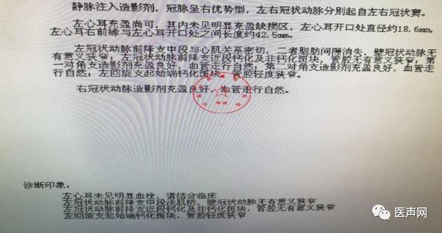 WATCHMAN病例竞赛 | 哈医大二院 规范流程下左心耳封堵一例