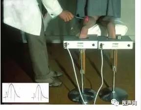 PCI 之父Grüntzig, 我身边的那个人