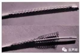 支架的创始人Sigwart ：支架是如何炼成的