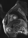 CTO case Discussion（一）宋现涛：逆向CTO-PCI一例