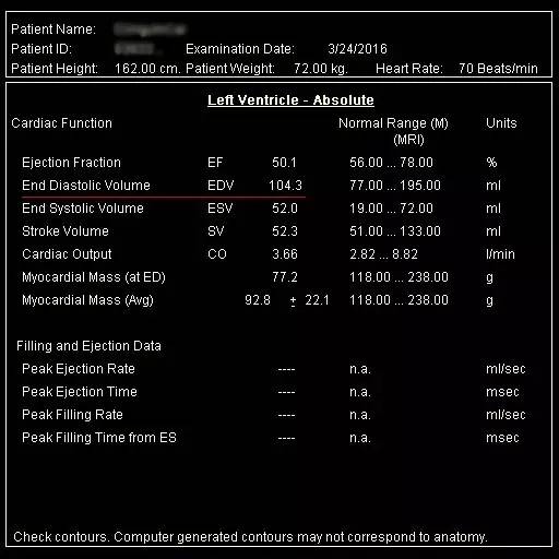 CTO case Discussion（一）宋现涛：逆向CTO-PCI一例