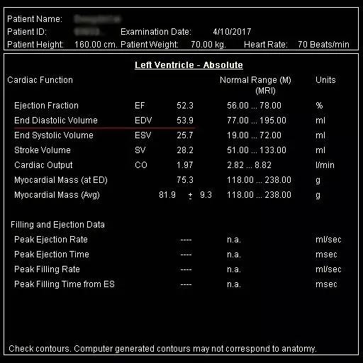 CTO case Discussion（一）宋现涛：逆向CTO-PCI一例