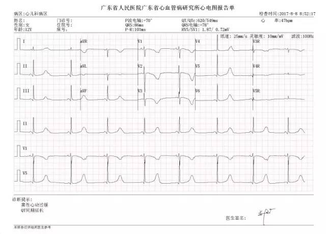 病例分享  曾少颖：12岁LQT综合症3型患者植入双腔ICD一例