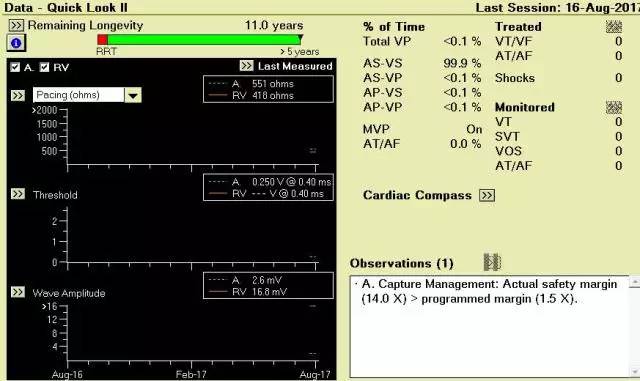 病例分享  曾少颖：12岁LQT综合症3型患者植入双腔ICD一例