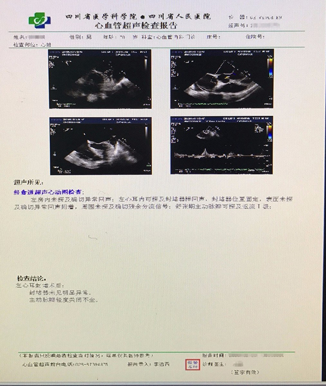 四川省人民医院 房颤伴CKD使用WATCHMAN左心耳封堵一例