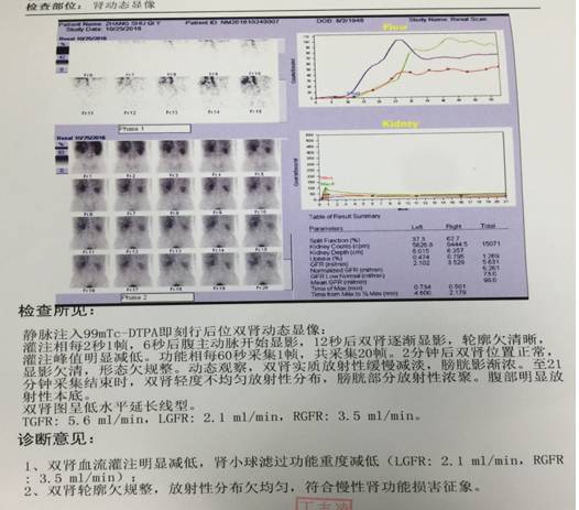四川省人民医院 房颤伴CKD使用WATCHMAN左心耳封堵一例