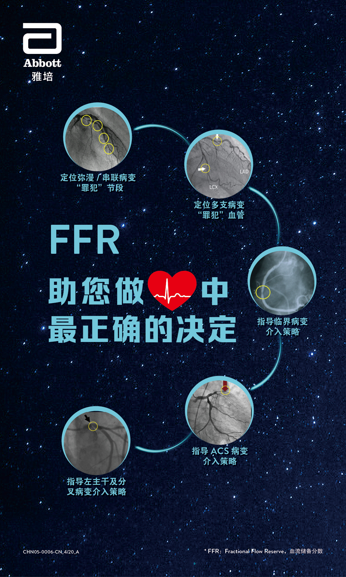 FFR适应症_竖板_CHN05-0006-CN_420_A.jpg