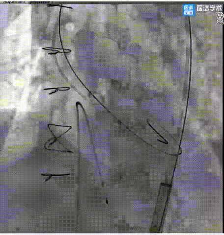 11.gif