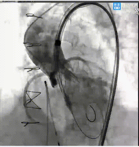 44.gif