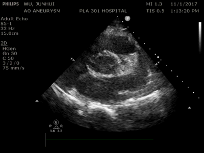 3.gif