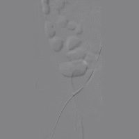 18.gif