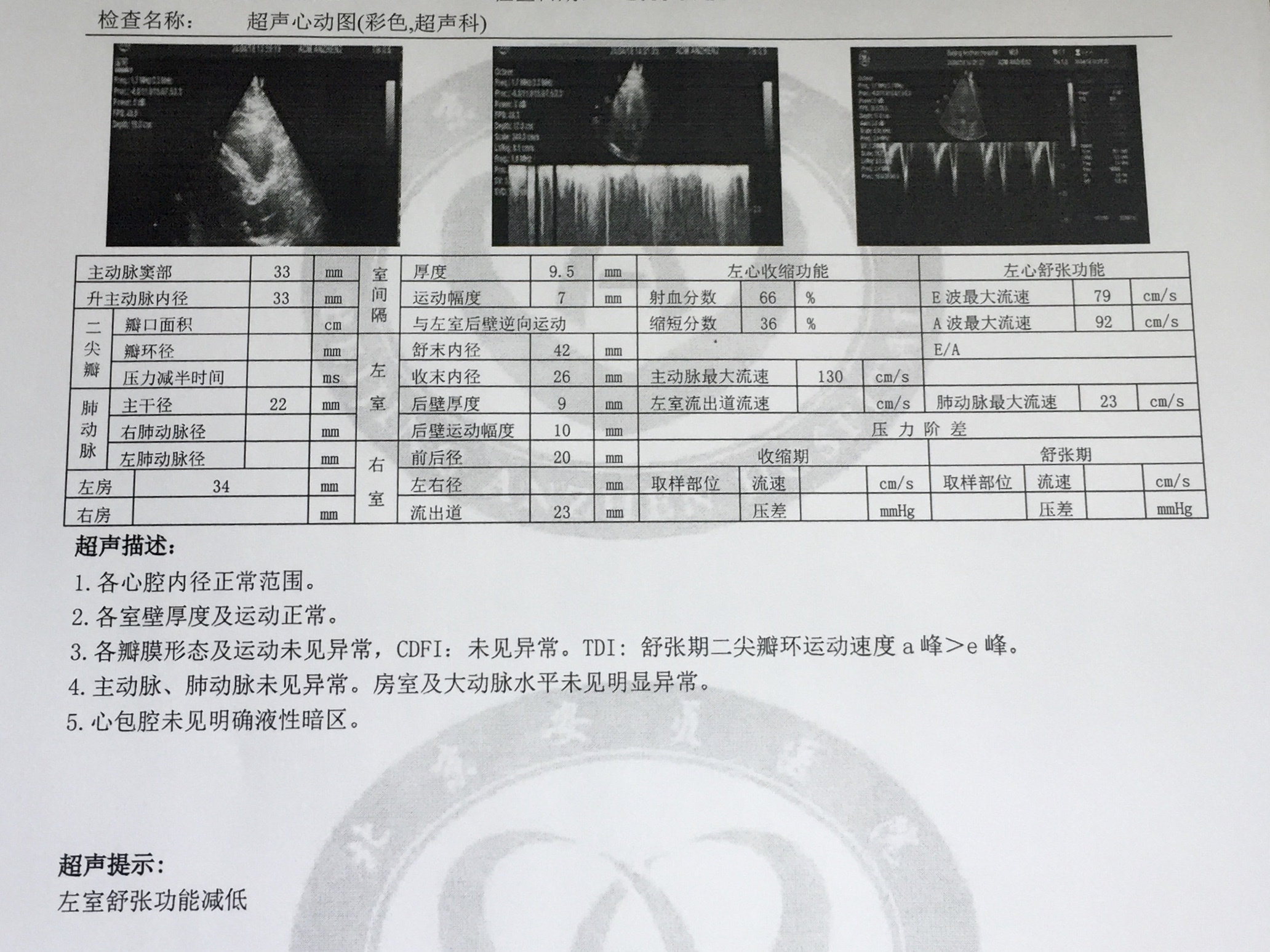 超声心动_副本.jpg