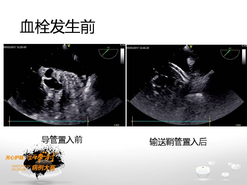 幻灯片5.JPG