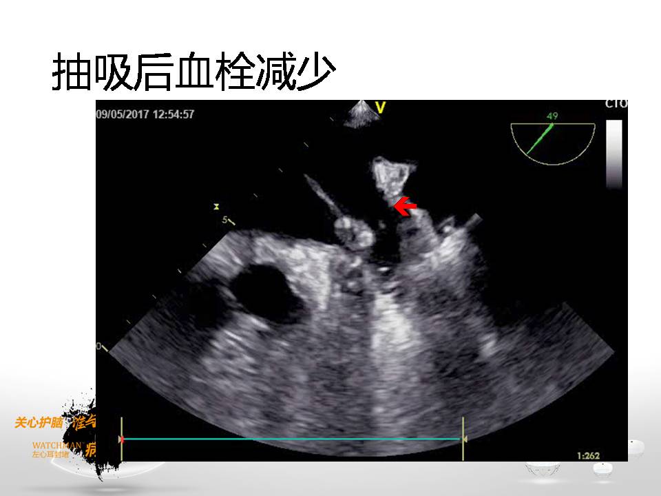 幻灯片9.JPG