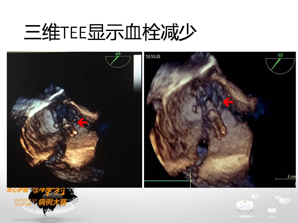 幻灯片10.JPG
