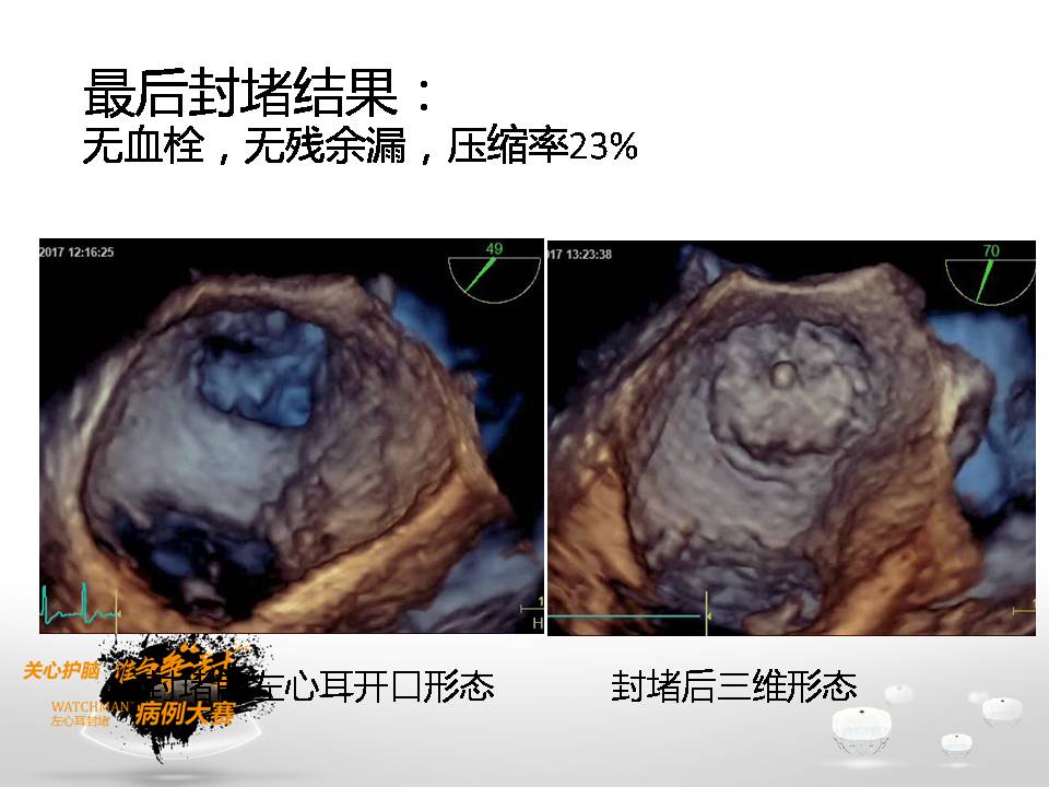 幻灯片14.JPG