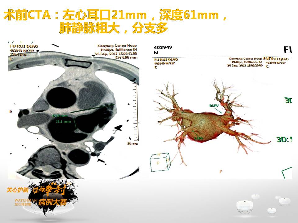 幻灯片6.JPG