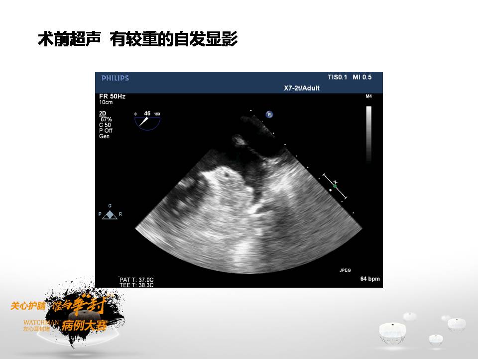 幻灯片5.JPG