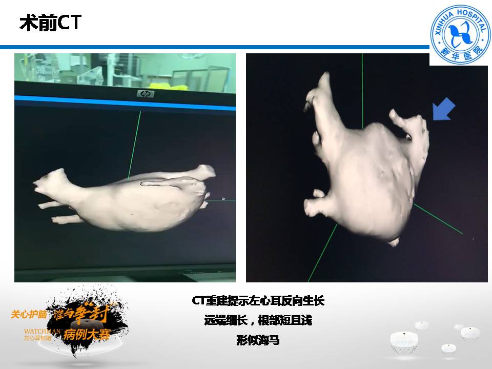 幻灯片4.JPG